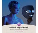 Shark CryoGlow Under-Eye LED Mask Lilac - Chill thumbnail 5