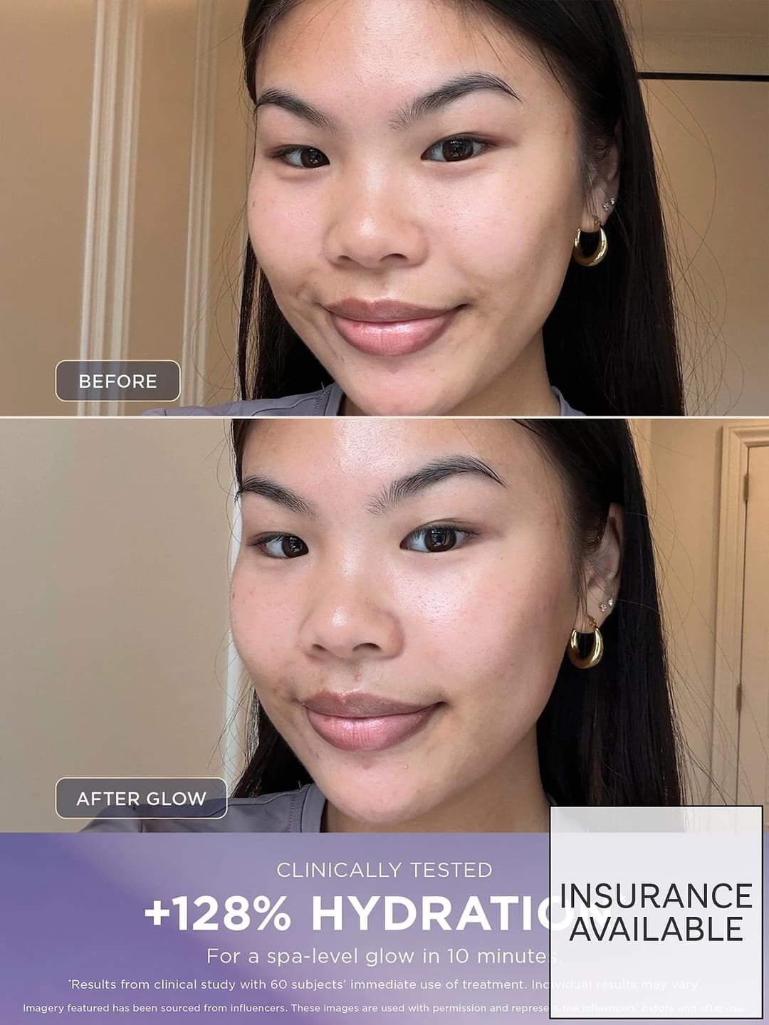 SHARK FacialPro Glow + DePuffi At Home Facial - Spa Purple - Image 3