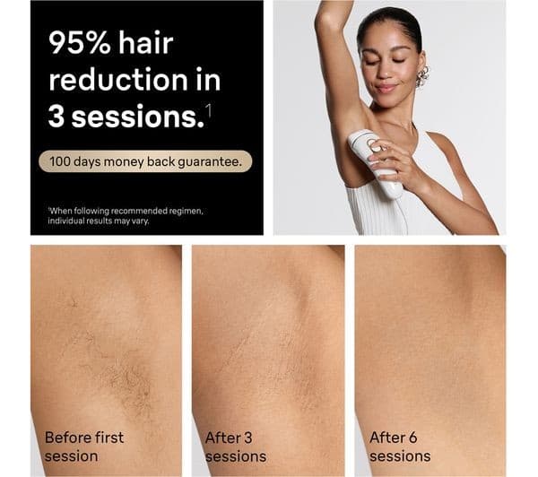 BRAUN Silk-expert Pro 5 PL5351 IPL Hair Removal System - White - Image 7