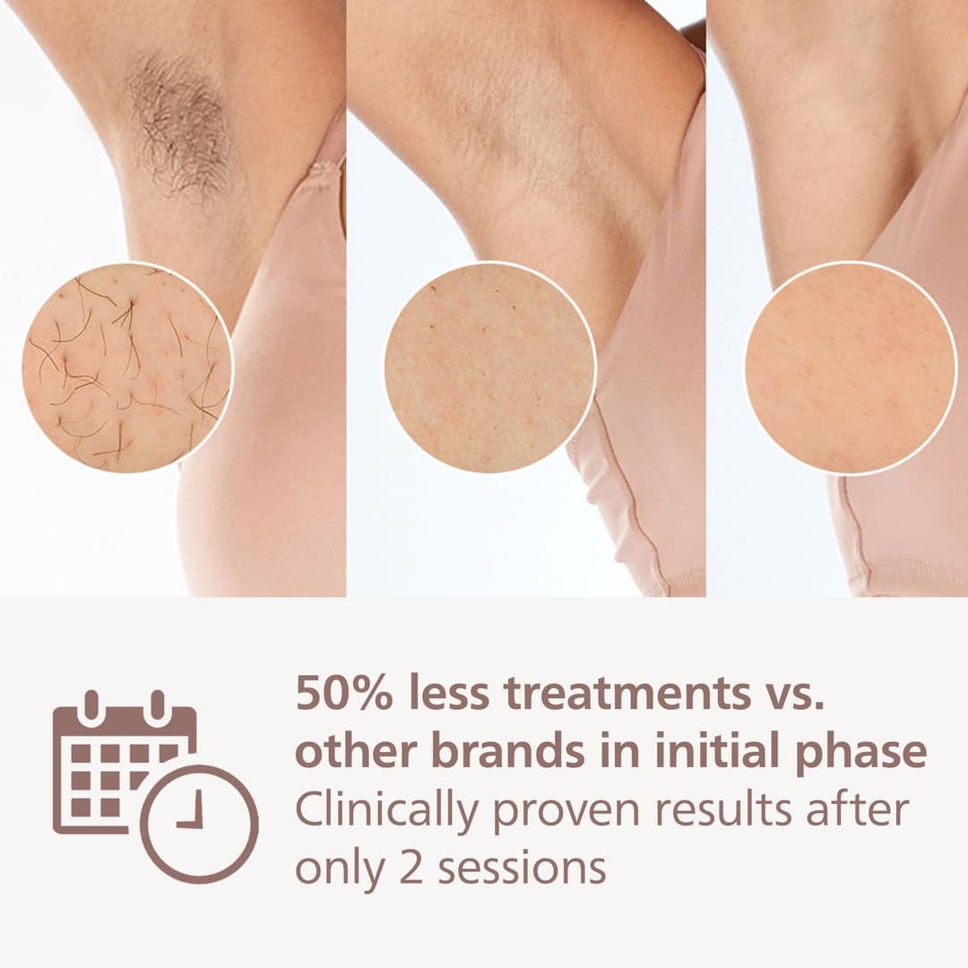 Philips Lumea 9000 Series IPL Hair Removal Device - White - Image 4