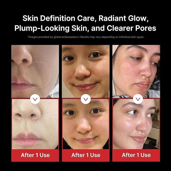 Medicube AGE-R Booster Pro 6-in-1 Skincare Device - Black - Image 4