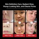 Medicube AGE-R Booster Pro 6-in-1 Skincare Device - Black thumbnail 4
