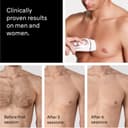 Braun Smart IPL Skin i-Expert Hair Removal Device PL7321 - White/Rose Gold thumbnail 8