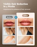 Haarlosy IPL Laser Hair Removal Device 3-in-1, 9 Levels, 999,900 Flashes, Auto Mode - White Gold thumbnail 9
