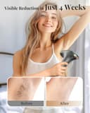 Haarlosy IPL Laser Hair Removal Device 3-in-1, 9 Levels, 999,900 Flashes, Auto Mode - Dark Grey thumbnail 10