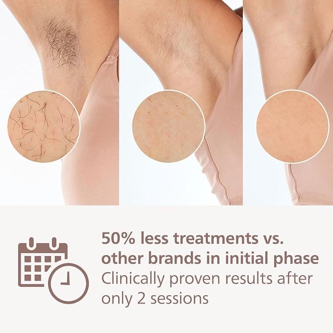 Philips Lumea Advanced IPL Hair Removal Device BRI921/00 - Image 4
