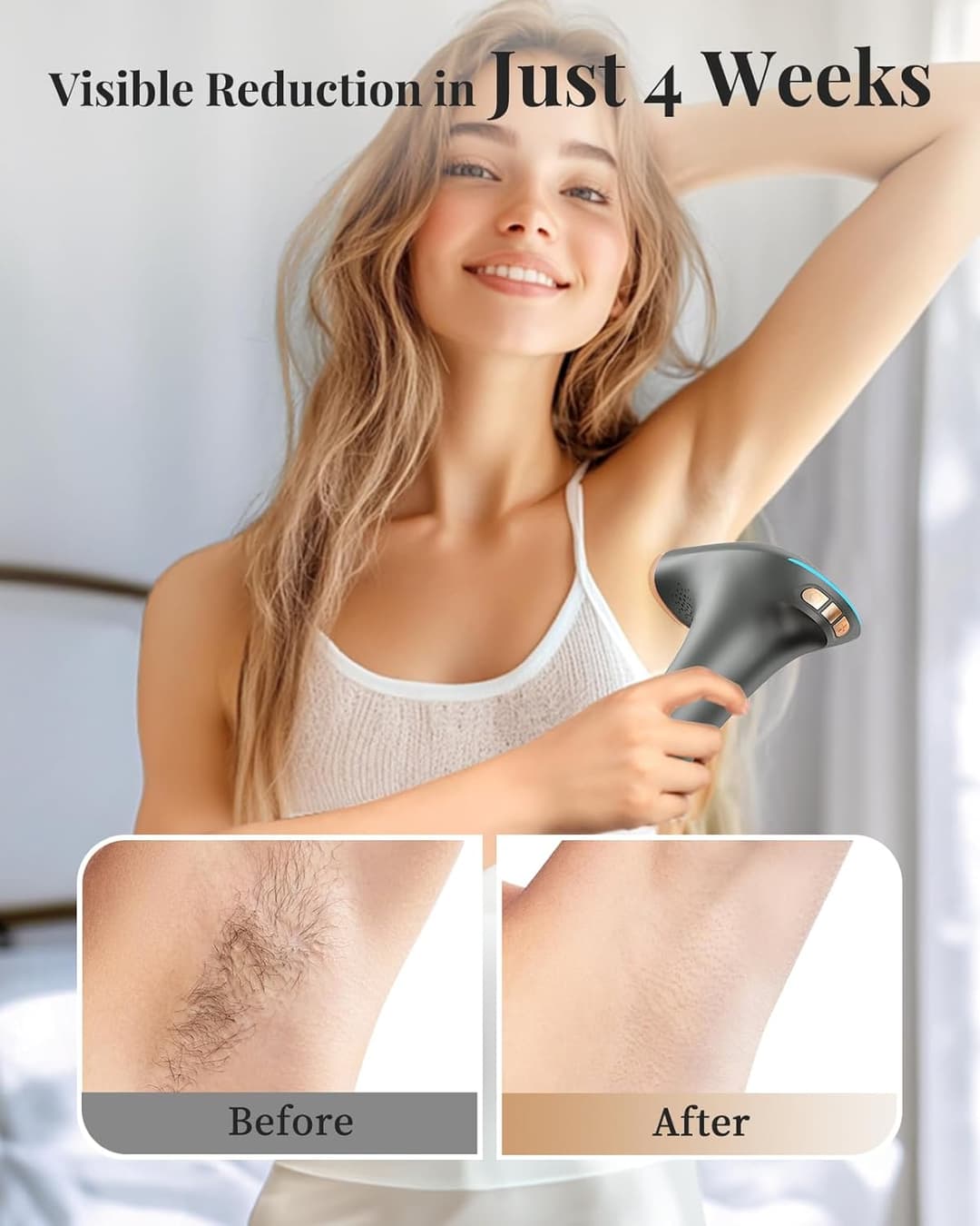 Haarlosy IPL Laser Hair Removal Device 3-in-1, 9 Levels, 999,900 Flashes, Auto Mode - Dark Grey - Image 3